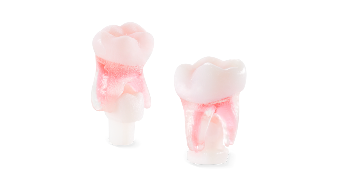 Endo 3DP pediatric endo teeth