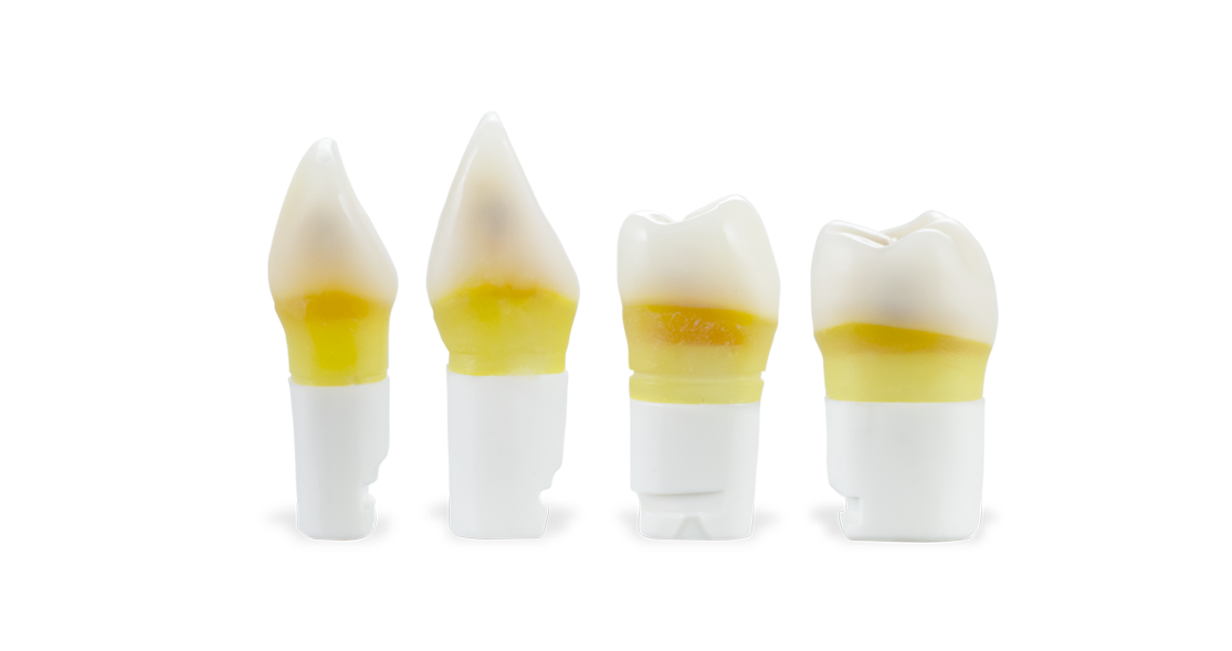 DTX Carious teeth