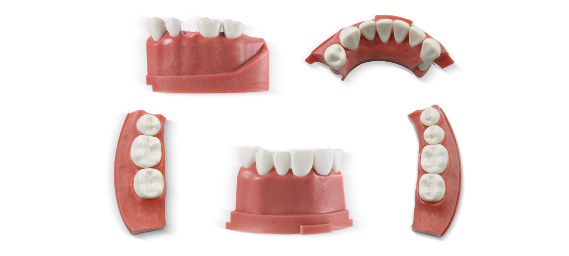 Individual ModuPRO Pros replacement modules with M200 teeth