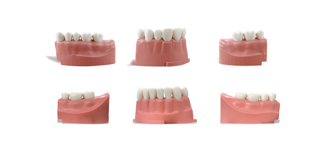 ModuPRO One Upper and Lower Gums with M300 teeth