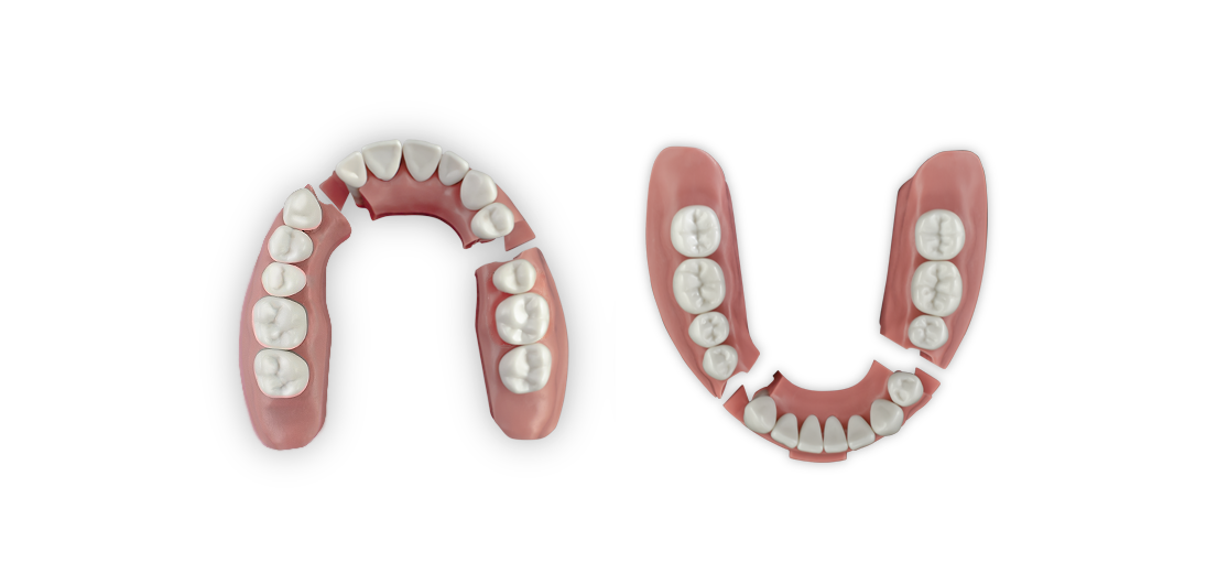 ModuPRO One Upper and Lower Gums without teeth